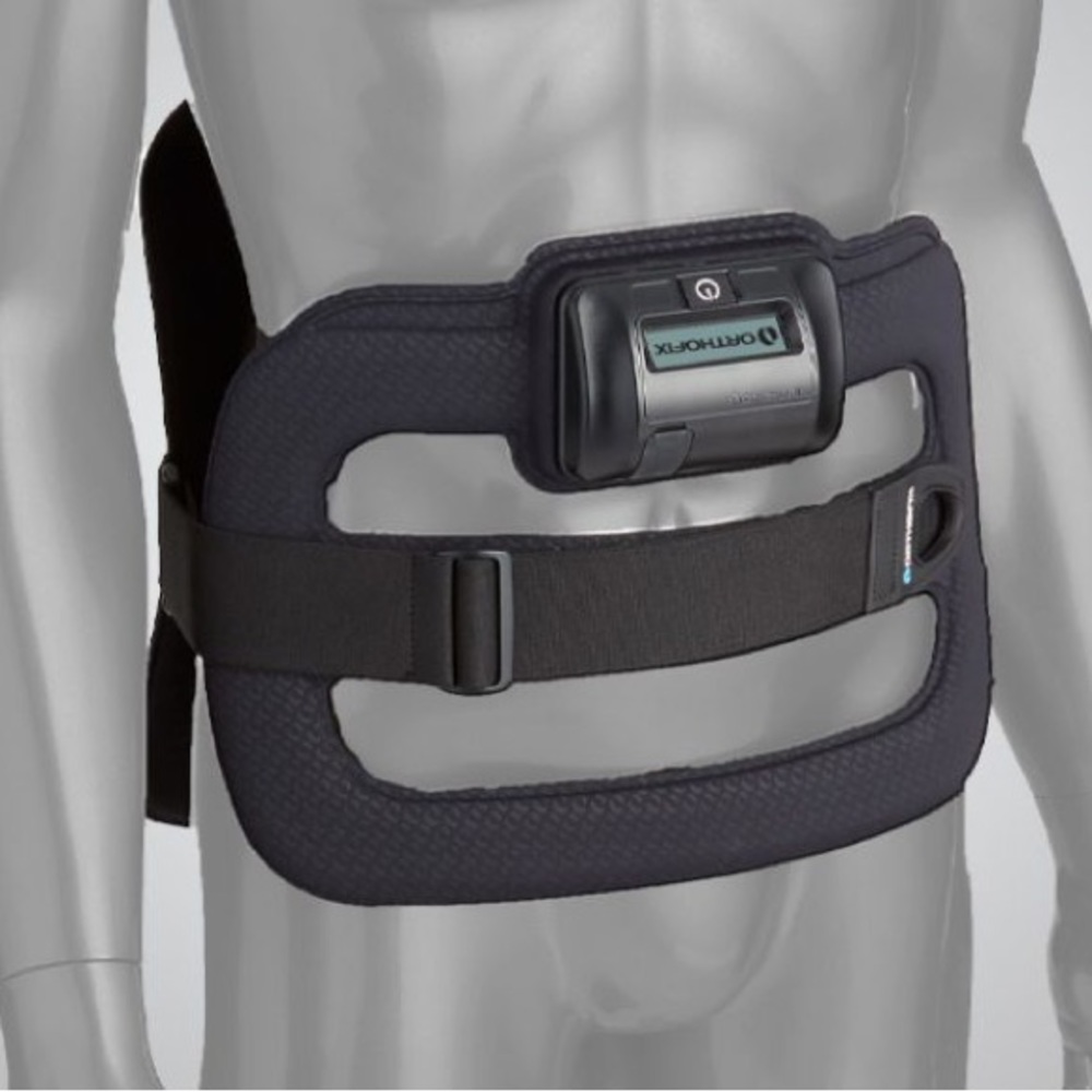 ORTHOFIX Spinal-Stim Osteogenesis Stimulator